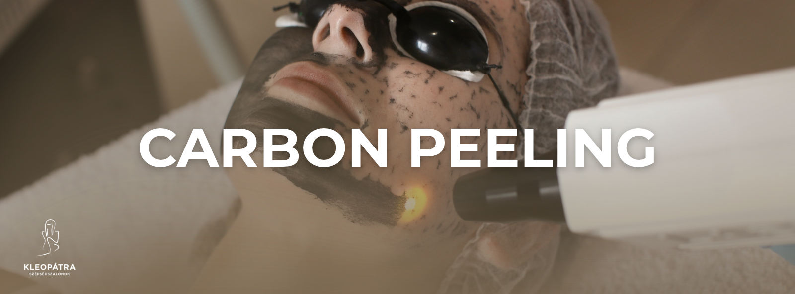 Carbon peeling.png